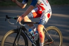 19-holloway_lost_some_skin_at_the_tour_de_francis